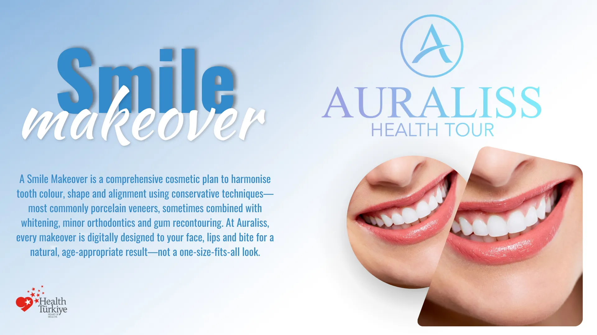 smile makeover