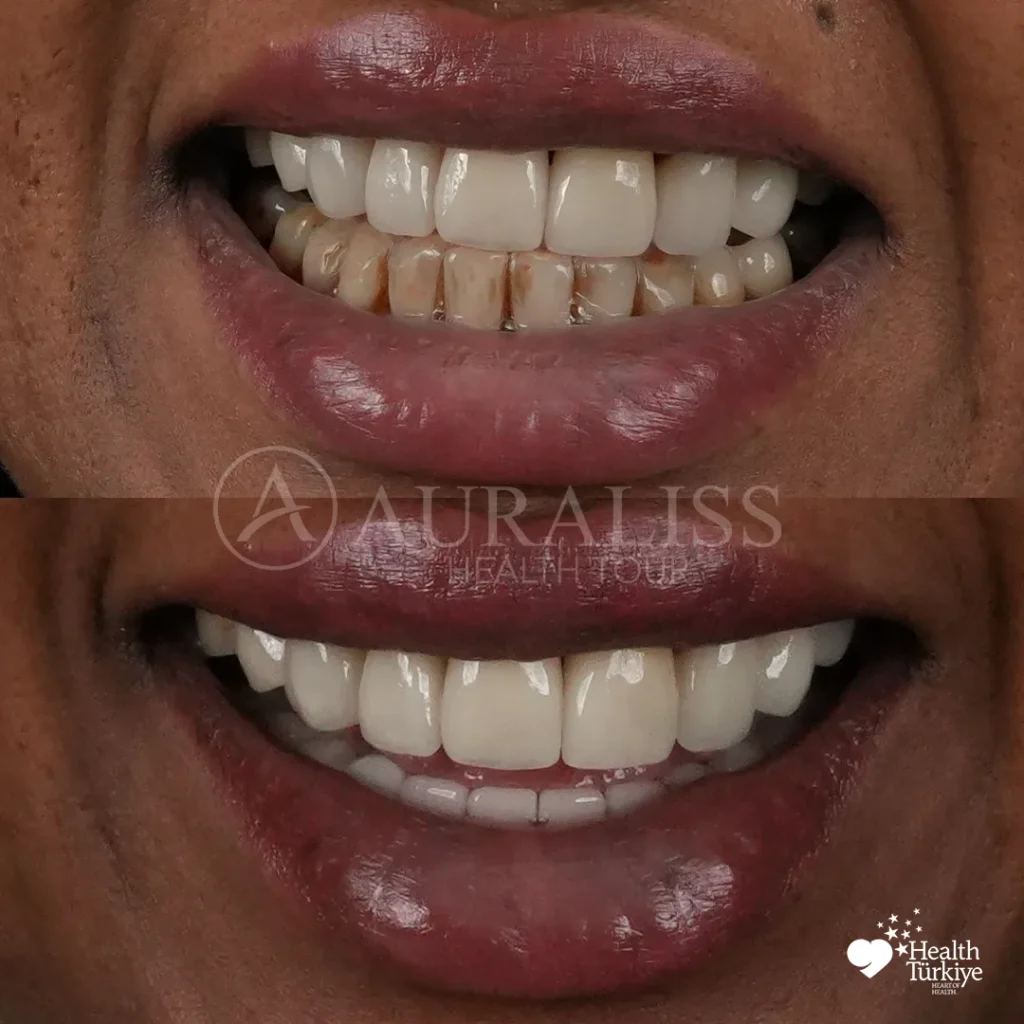 MISS AYAN IBRAHIM Before After