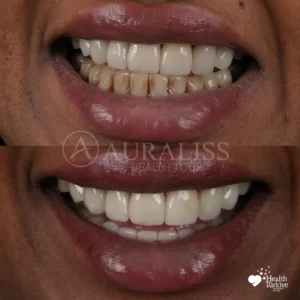 MISS IBRAHIM - Before After