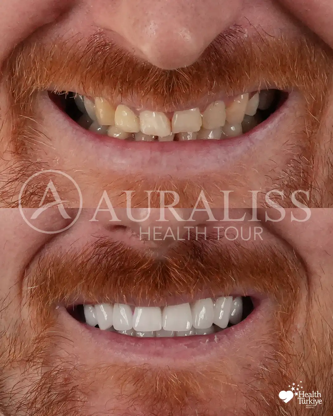 Before dental treatment result